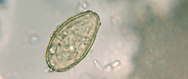 Описторхоз