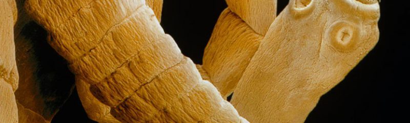 Нейроцистицеркоз: симптомы и лечение болезни