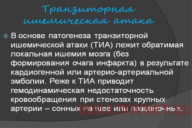 Транзиторная ишемическая атака мозга