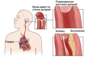 Что происходит в организме при давлении