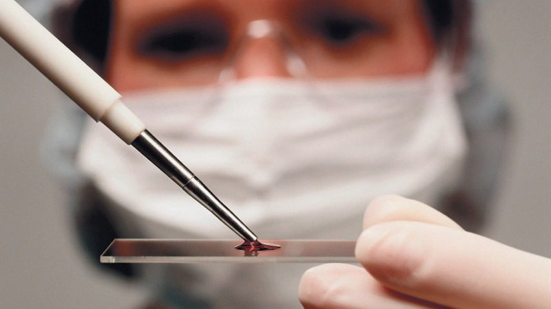 малярия у детей