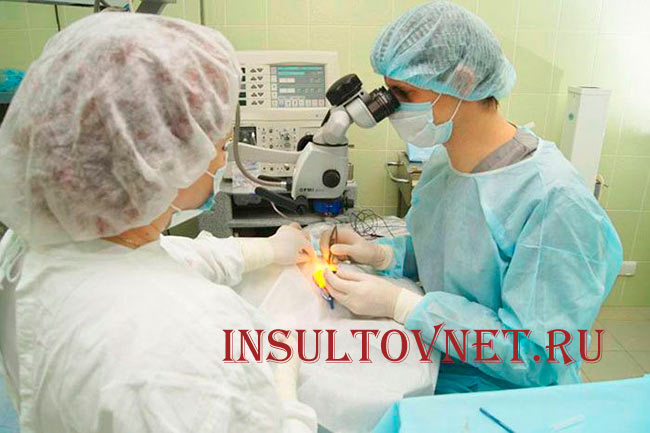 Операция на глаза