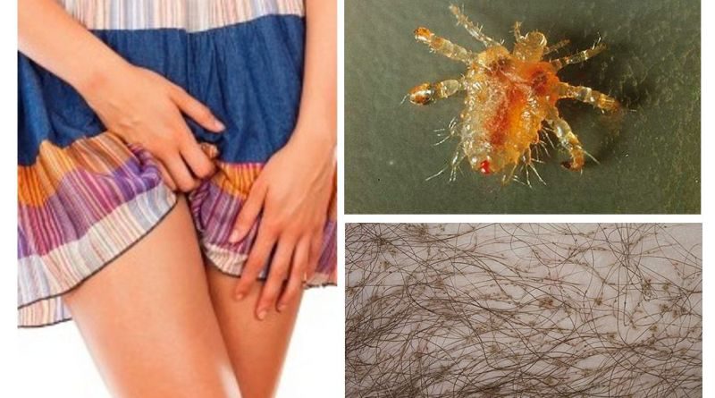 лобковые вши