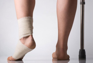 Нога в бинте Усталостный перелом