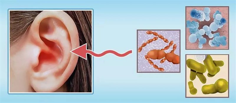 пути заражения