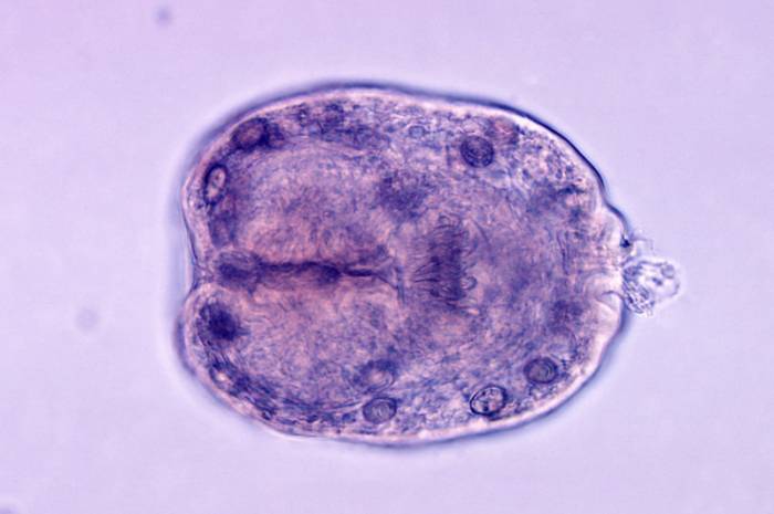 Эхинококк альвеолярный