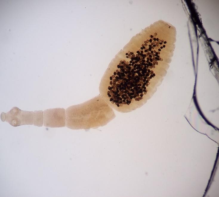 Как выглядит эхинококкоз