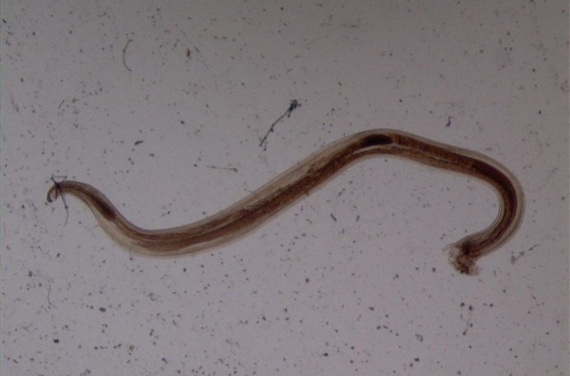 анкилостома