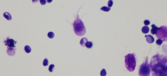 Чем лечить лямблии: препараты