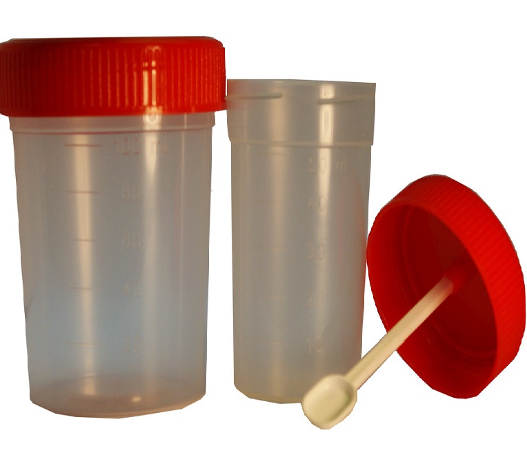 Баночки для анализа кала для исследования на описторхоз