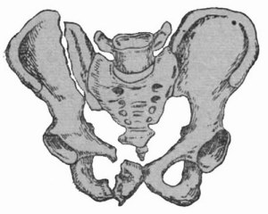 Повреждения тазовых костей Перелом тазовой кости