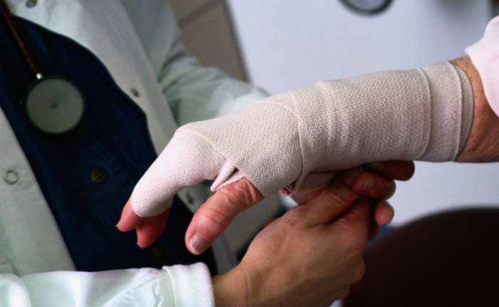 перелом руки