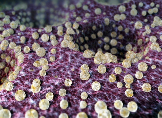 хламидии в мазке