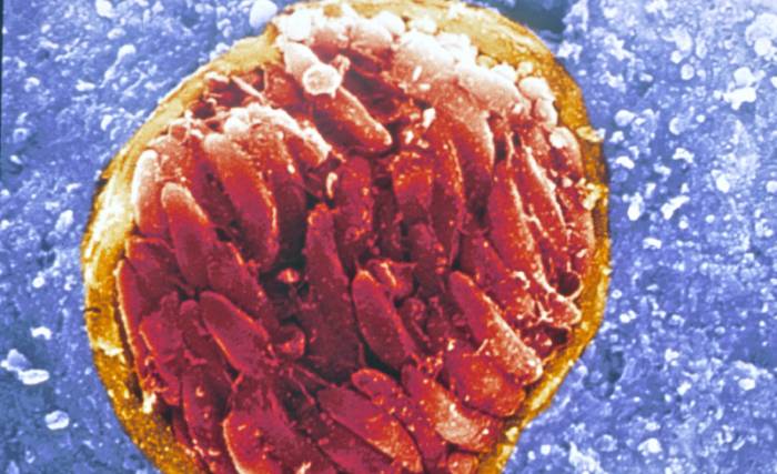 Токсоплазмоз