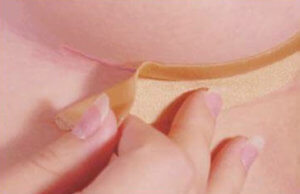 Противопоказания пластыря Дерматикс силиконового