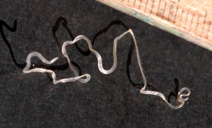 дирофилярий внелегочный