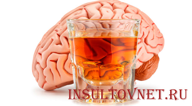 Алкоголь и инсульт