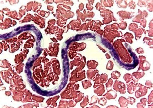 Описание гельминта