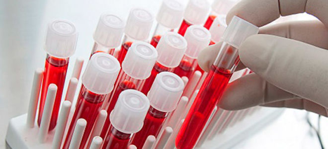 Анализы на лямблиоз у детей