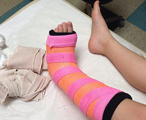 Упражнение здоровой ногой В первое время необходимо делать упражнения здоровой ногой