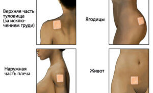 Применение перцового пластыря от целлюлита