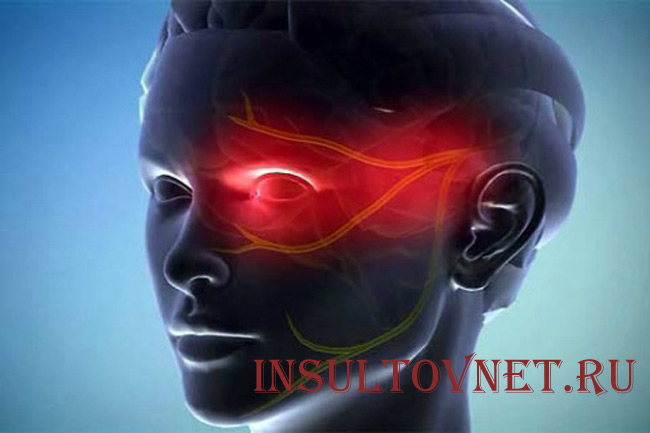 Болит левое полушарие головы