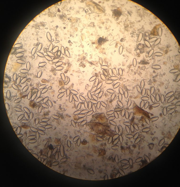 яйца остриц