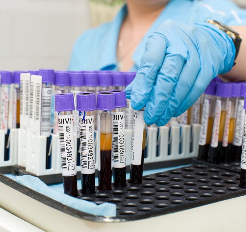 Серологическое исследование