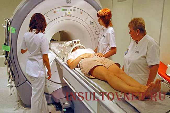 Мрт головного мозга