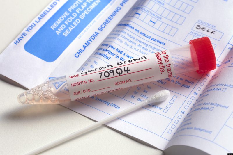 Анализы на хламидиоз