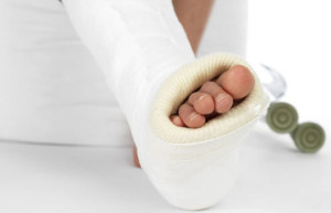 Нога в гипсе Двухлодыжечный перелом