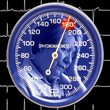 Причины инсульта