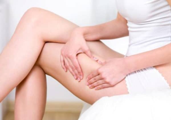 Диагностика целлюлита