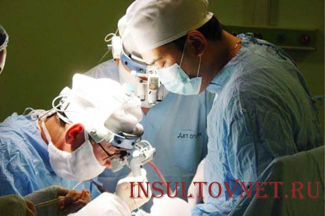 Операция при инсульте