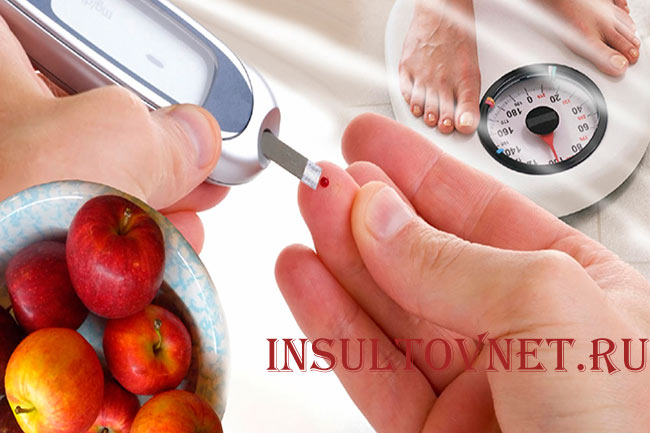 Сахарный диабет