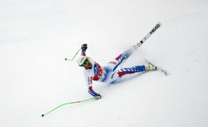 падение на лыжах Причинами могут быть спортивные или производственные травмы