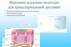 Эффективность пластыря Фентанил