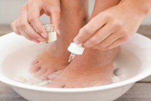 Лечение мозолей и натоптышей на ногах