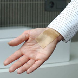 Использование пластыря Дерматикс от рубцов