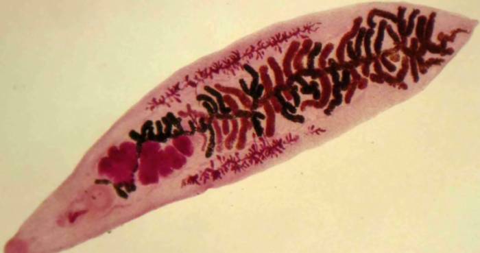 Печеночная двуустка