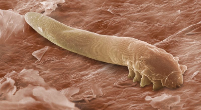 подкожные паразиты