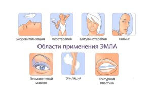 Области применения крема Эмла