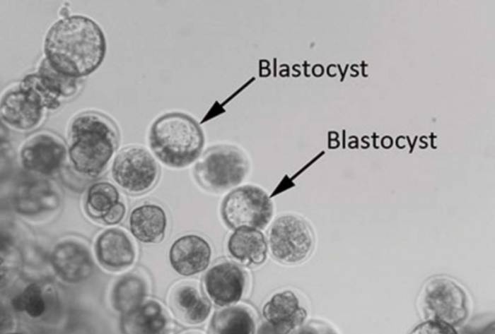 Бластоцисты