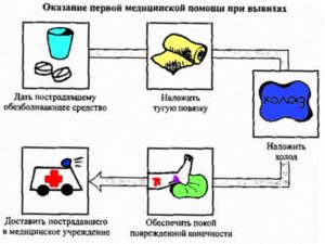 Оказание первой помощи при вывихе голеностопа Первая помощь при вывихе