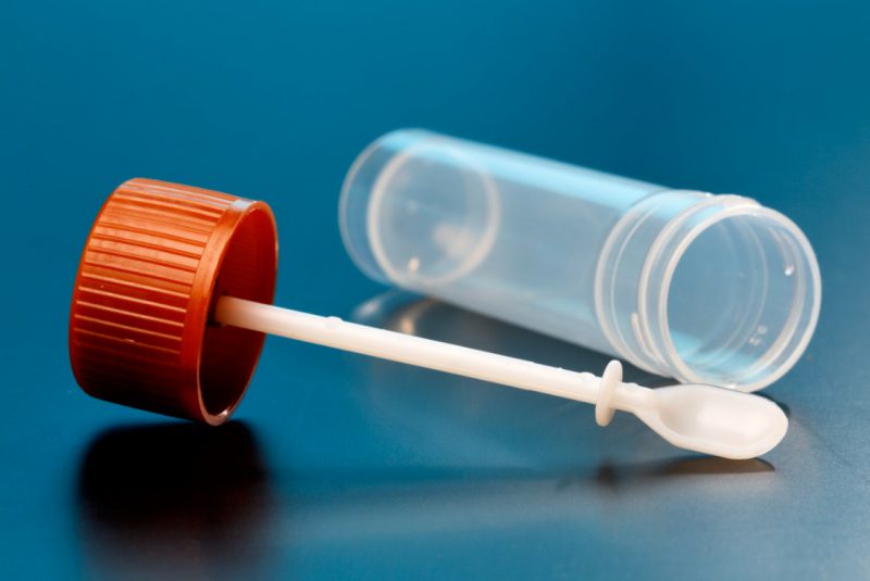 баночка для анализа