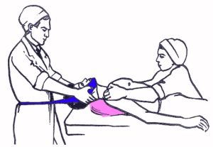 Применение петли Глиссона Петля Глиссона