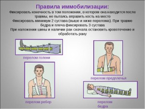 Правила при переломах Правила иммобилизации