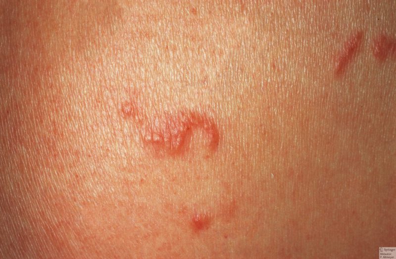 Первые признаки