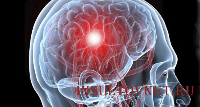 Гематома головного мозга