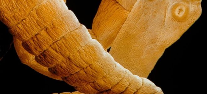 Карликовый цепень и лечение гименолепидоза